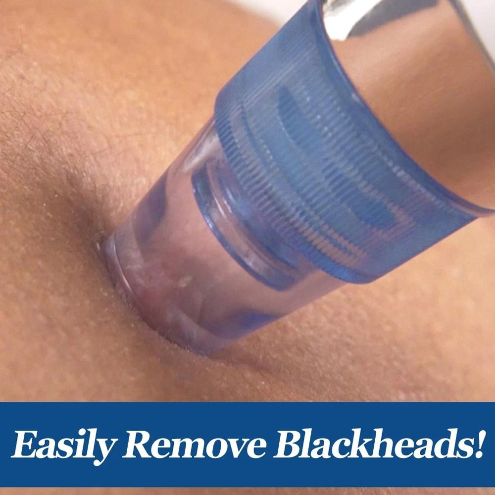 4 In 1 Blackhead Whitehead Extractor Remover Device Acne Pimple Pore Cleaner